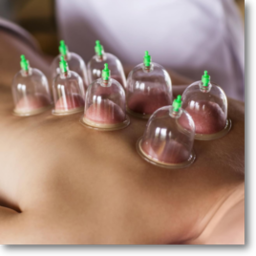 Cupping therapie